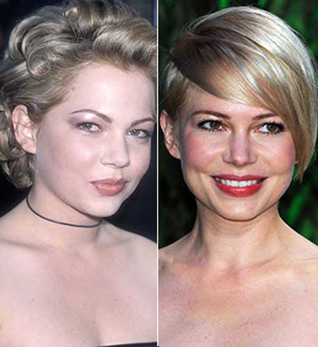 Michelle Williams plastic surgery