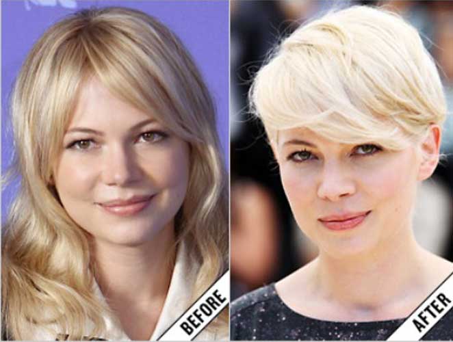 Michelle Williams plastic surgery