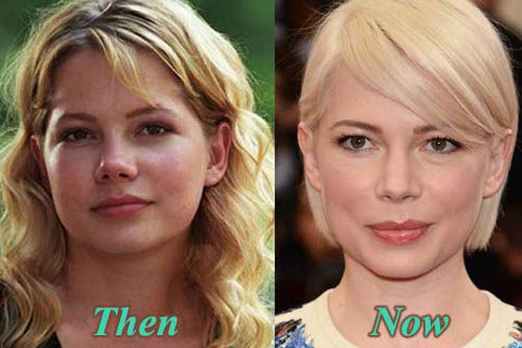 Michelle Williams Plastic Surgery Nose Job Botox After And Before Ryan gosl...