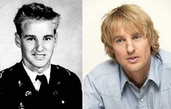 Owen Wilson Nose Job: Plastic Surgery and Rhinoplasty