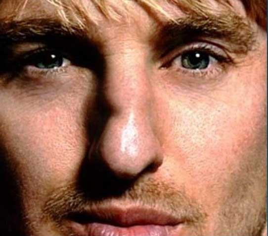 Owen Wilson Plastic surgery