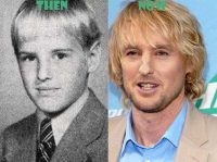 Owen Wilson Nose Job: Plastic Surgery and Rhinoplasty