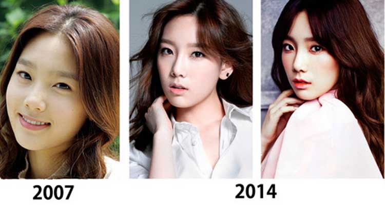 Taeyeon plastic surgery