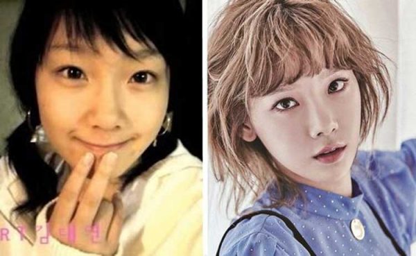 Taeyeon Plastic Surgery Jaw Surgery, Eyelid surgery, Nose Job