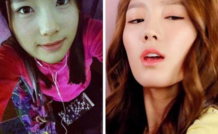 Taeyeon plastic surgery