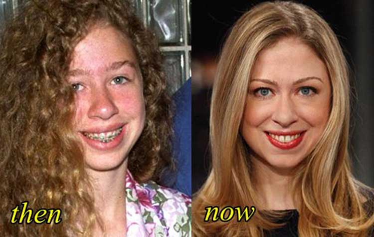 Chelsea Clinton