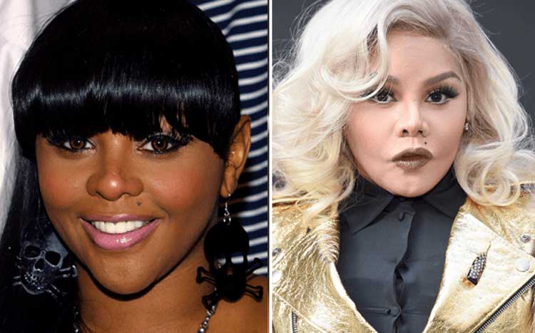 Lil Kim plastic surgery 