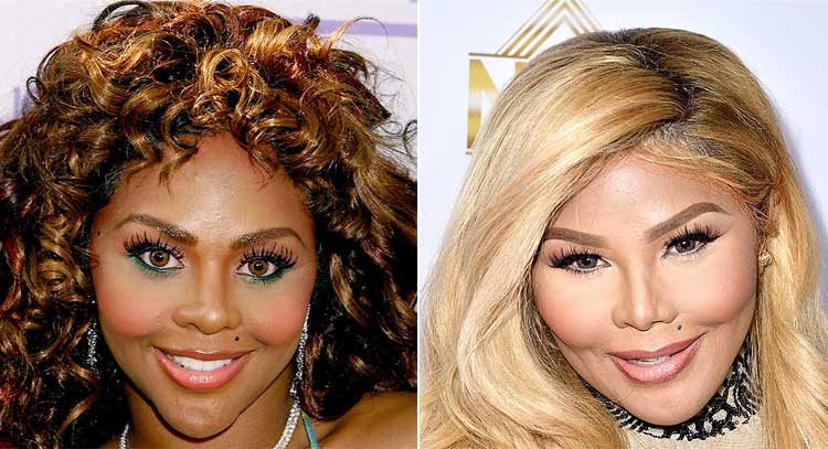 Lil Kim plastic surgery 