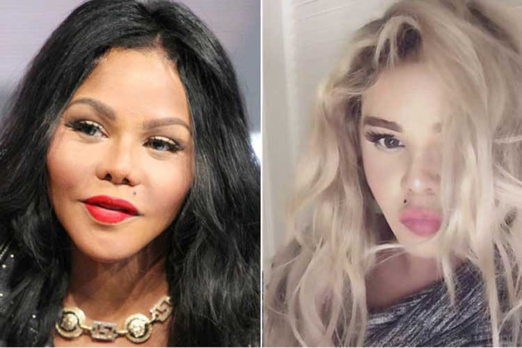 Lil Kim plastic surgery 