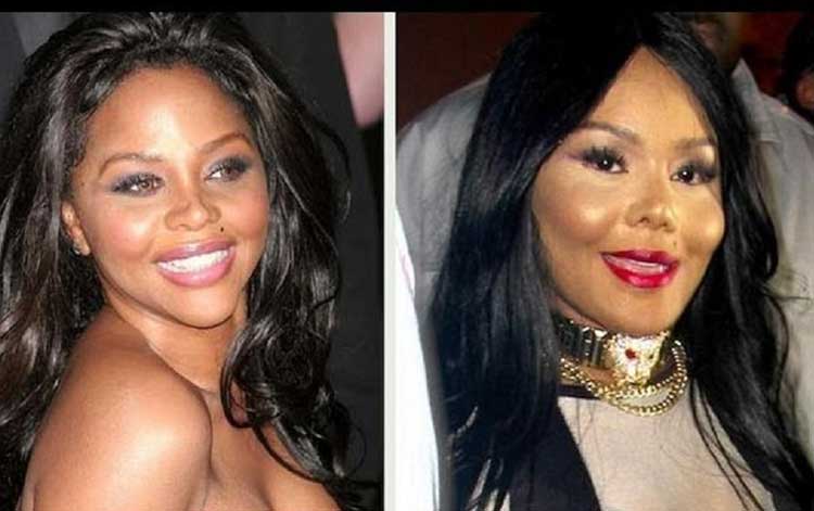 Lil Kim Plastic Surgery: Nose job, Lip Augmentation, Botox