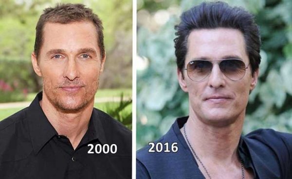 Matthew Mcconaughey Plastic Surgery: Nose Job, Facelift, Baldness