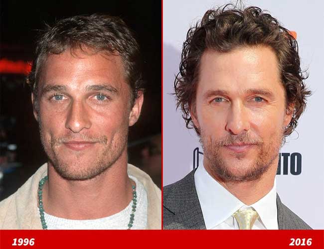 Matthew Mcconaughey plastic surgery