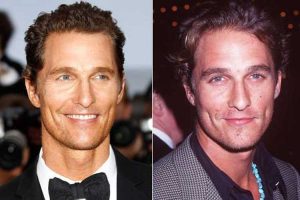 Matthew Mcconaughey Plastic Surgery: Nose Job, Facelift, Baldness