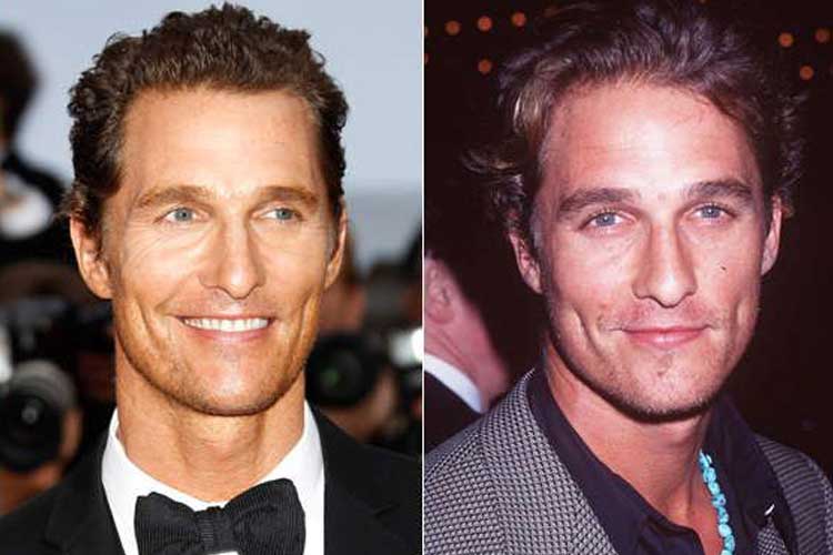 Matthew Mcconaughey plastic surgery