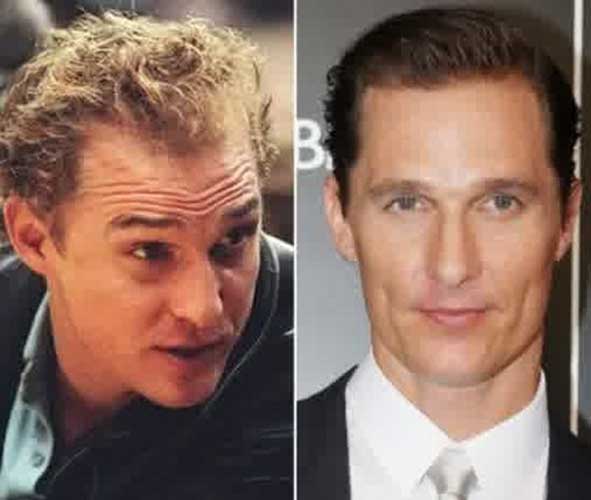 Matthew Mcconaughey plastic surgery