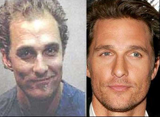 Matthew Mcconaughey Hairloss