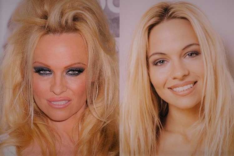 Pamela Anderson Plastic Surgery 