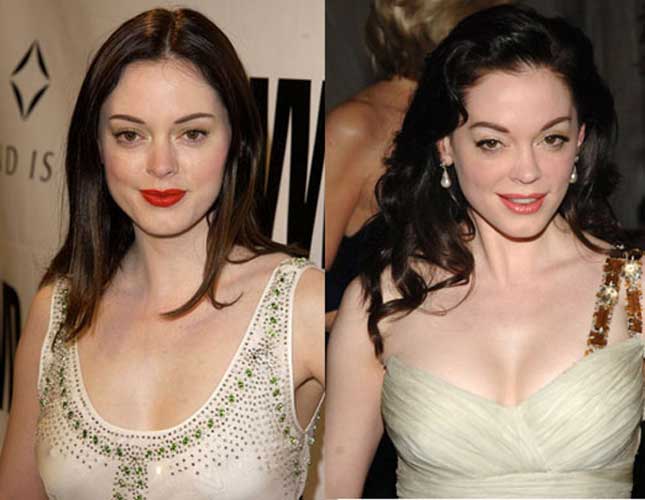 Rose McGowan Plastic Surgery 