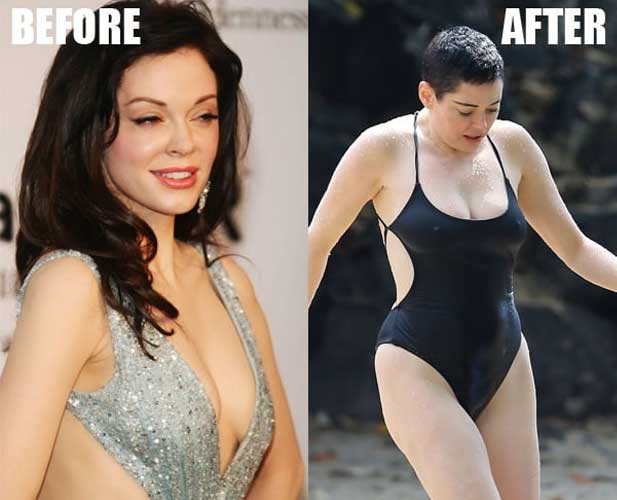 Rose McGowan Plastic Surgery 