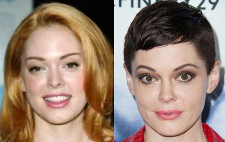 Rose McGowan Plastic Surgery 