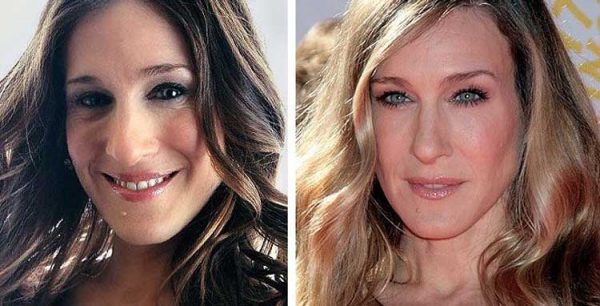 Sarah Jessica Parker Plastic Surgery: Nose job, Botox, After and Before