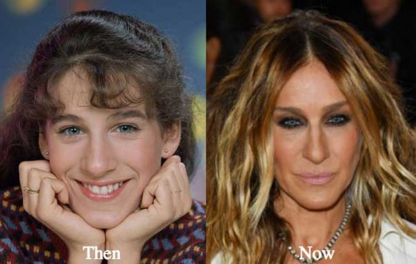 Sarah Jessica Parker Plastic Surgery Nose Job Botox After And Before