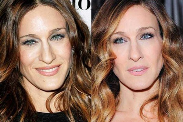 Sarah Jessica Parker Plastic Surgery Nose Job Botox After And Before