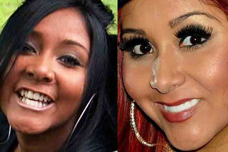 Snooki Plastic Surgery