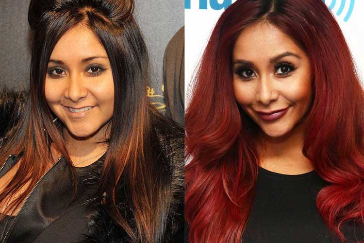 Snooki Plastic Surgery