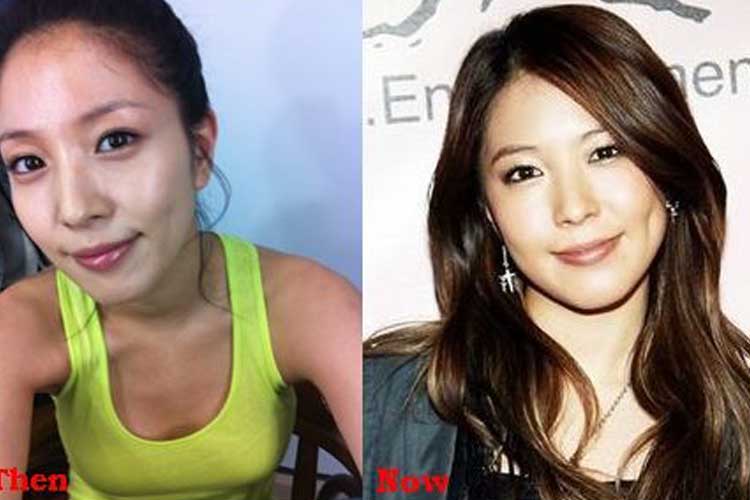 Boa plastic surgery