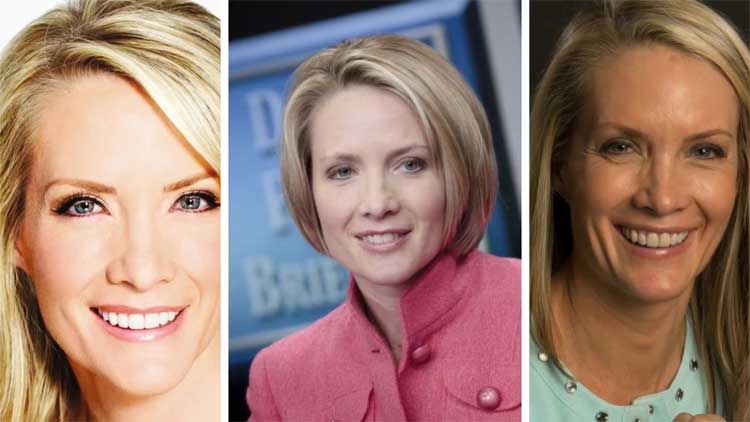 Dana Perino plastic surgery