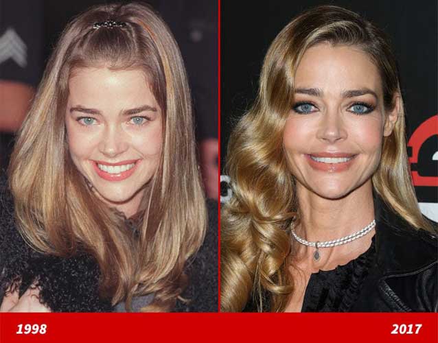 Denise Richards Plastic Surgery Breast Augmentation