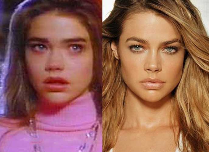 Denise Richards plastic surgery