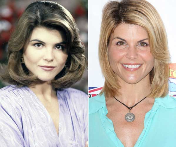 Lori Loughlin plastic surgery