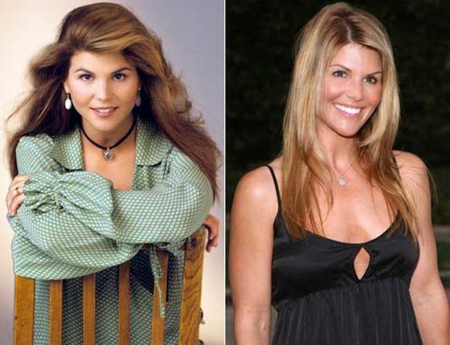 Lori Loughlin plastic surgery