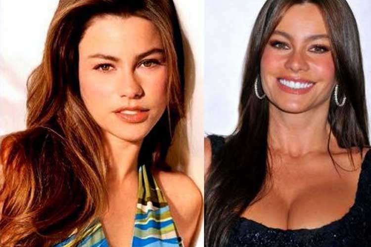 Sofia Vergara plastic surgery 