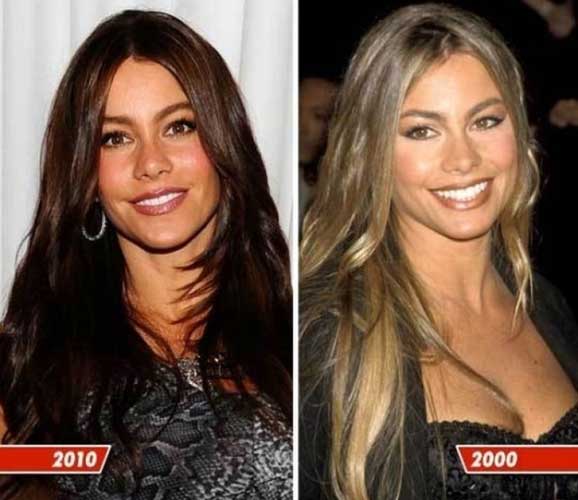 Sofia Vergara plastic surgery 