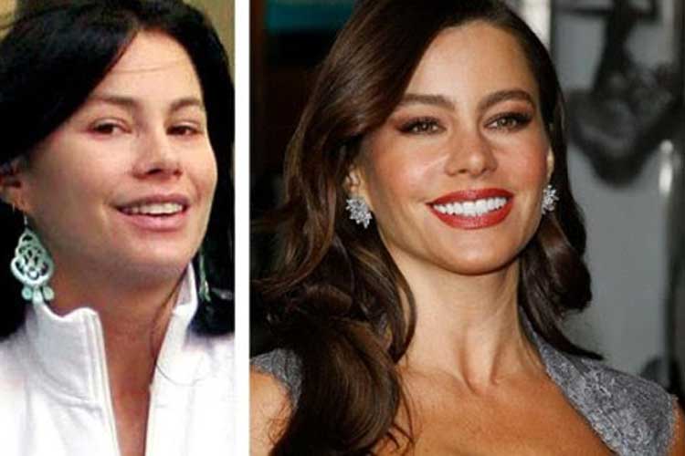 Sofia Vergara plastic surgery 