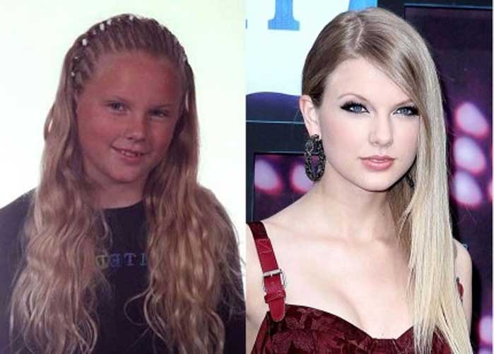 Taylor Swift plastic surgery