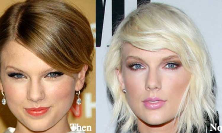 Taylor Swift plastic surgery