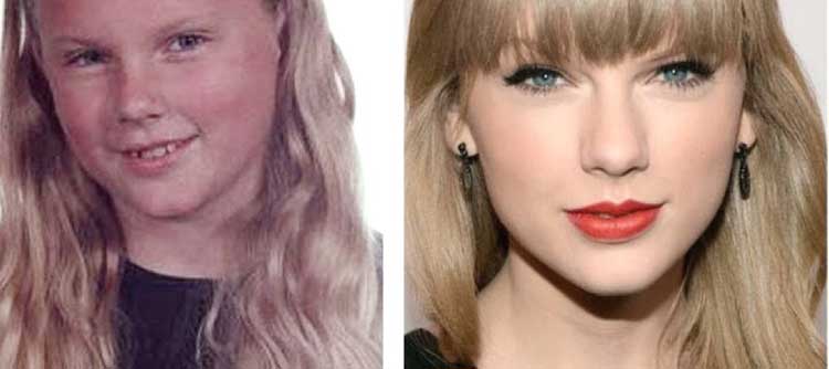 Taylor Swift Plastic Surgery Lets See How Her Looks And Styles Have