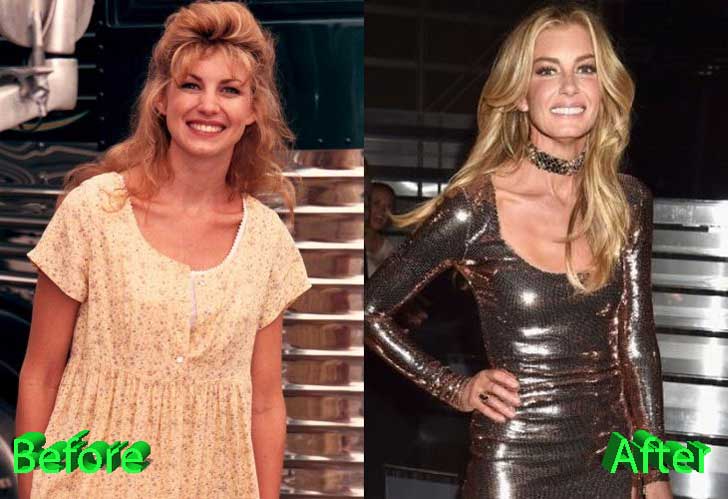 Faith Hill Plastic Surgery