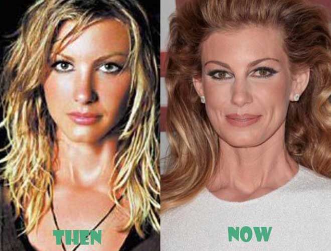 Faith Hill Plastic Surgery