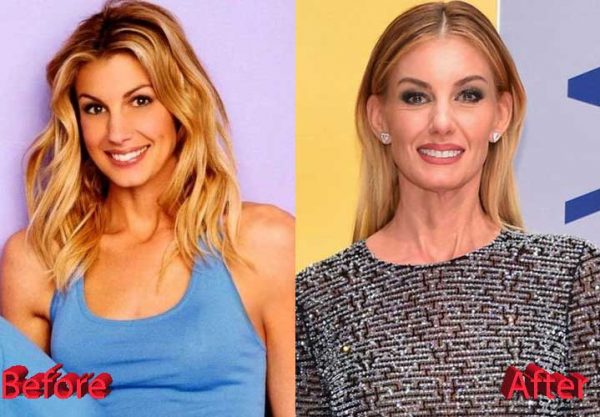 Faith Hill Plastic Surgery: Botox, Eyebrow surgery, Lip Filler