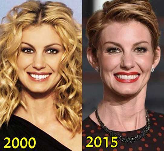 Faith Hill Plastic Surgery