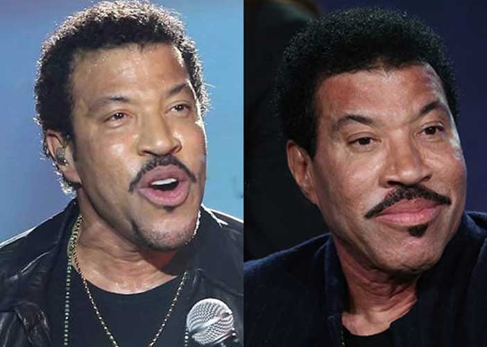 Lionel Richie Plastic Surgery