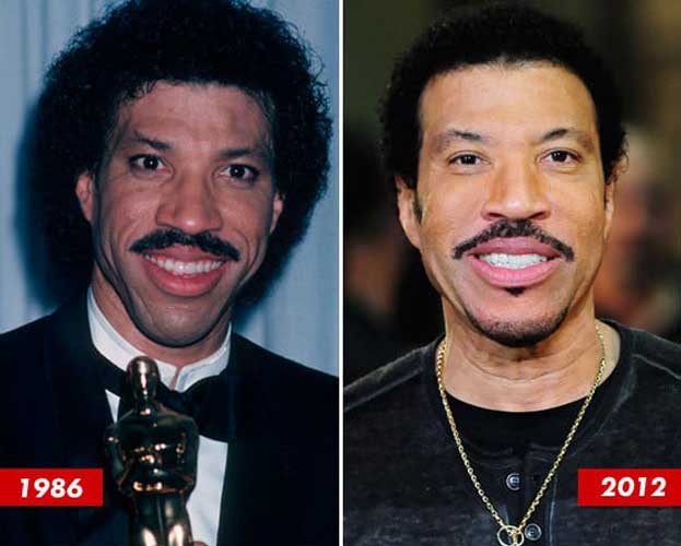 Lionel Richie Plastic Surgery