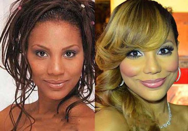 Tamar Braxton Plastic Surgery: Nose Job, Cheek Filler, Lip Filler