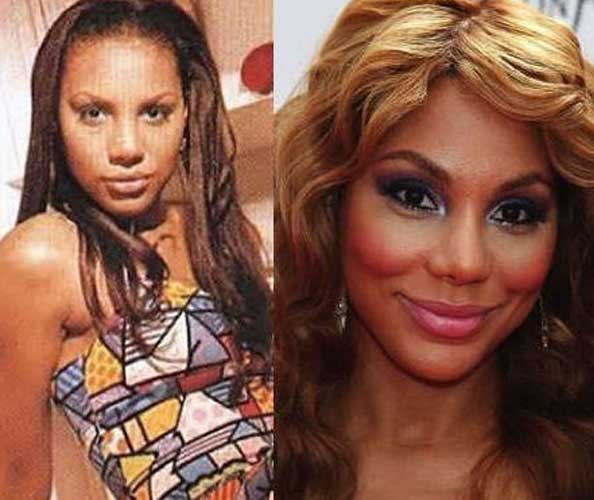 Tamar Braxton plastic surgery