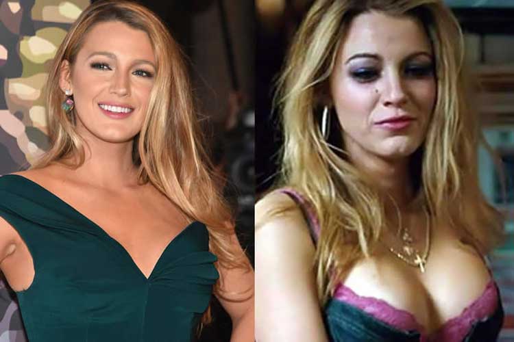 Blake Lively plastic surgery